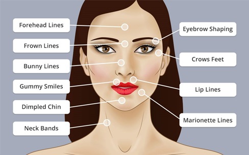 Botox Face Illustration1
