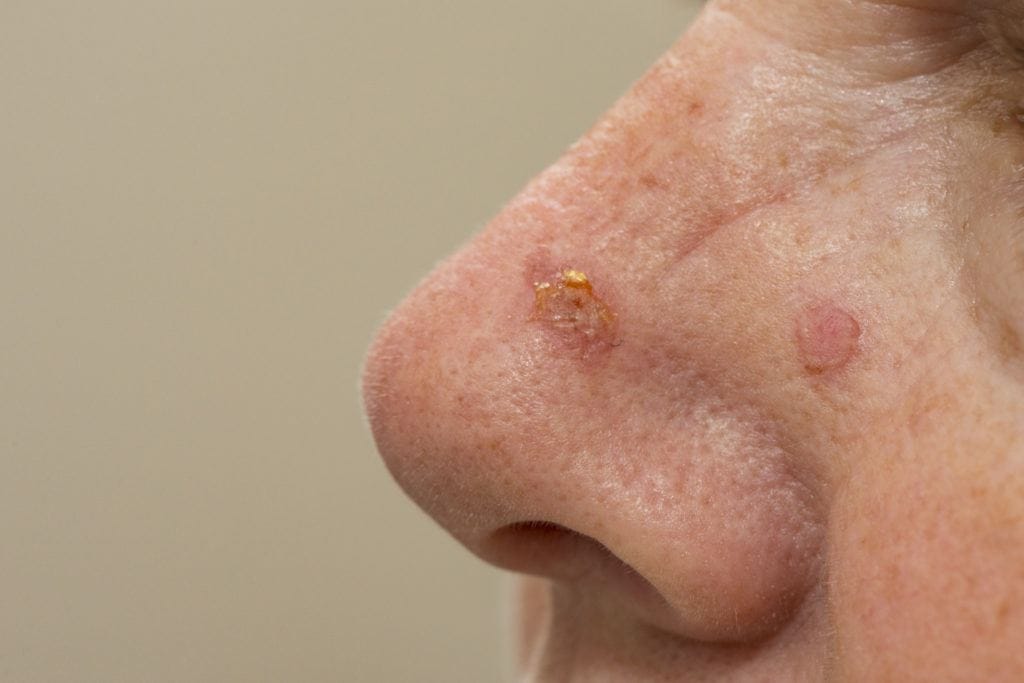 Craig Singer MD: Skin Care Specialist in Metro Detroit